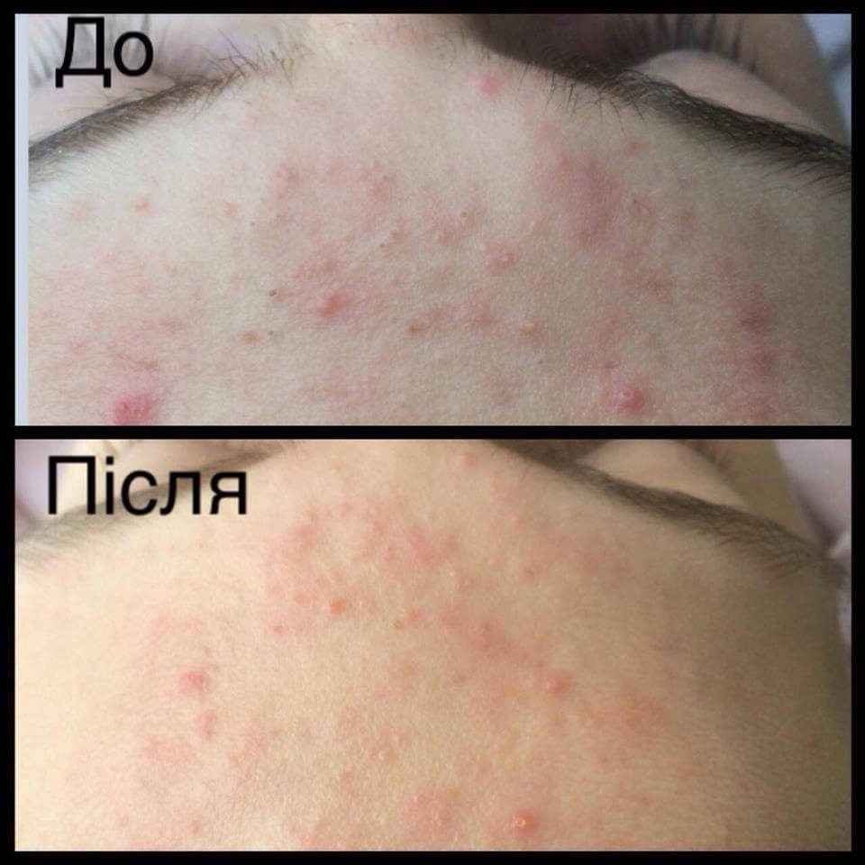 Косметологія